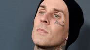 Travis Barker com grave pancreatite: "Risco de vida", desabafa - Getty Images