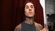 Travis Barker pré-internação: “dor extrema” e “mal conseguia andar” - Getty Images