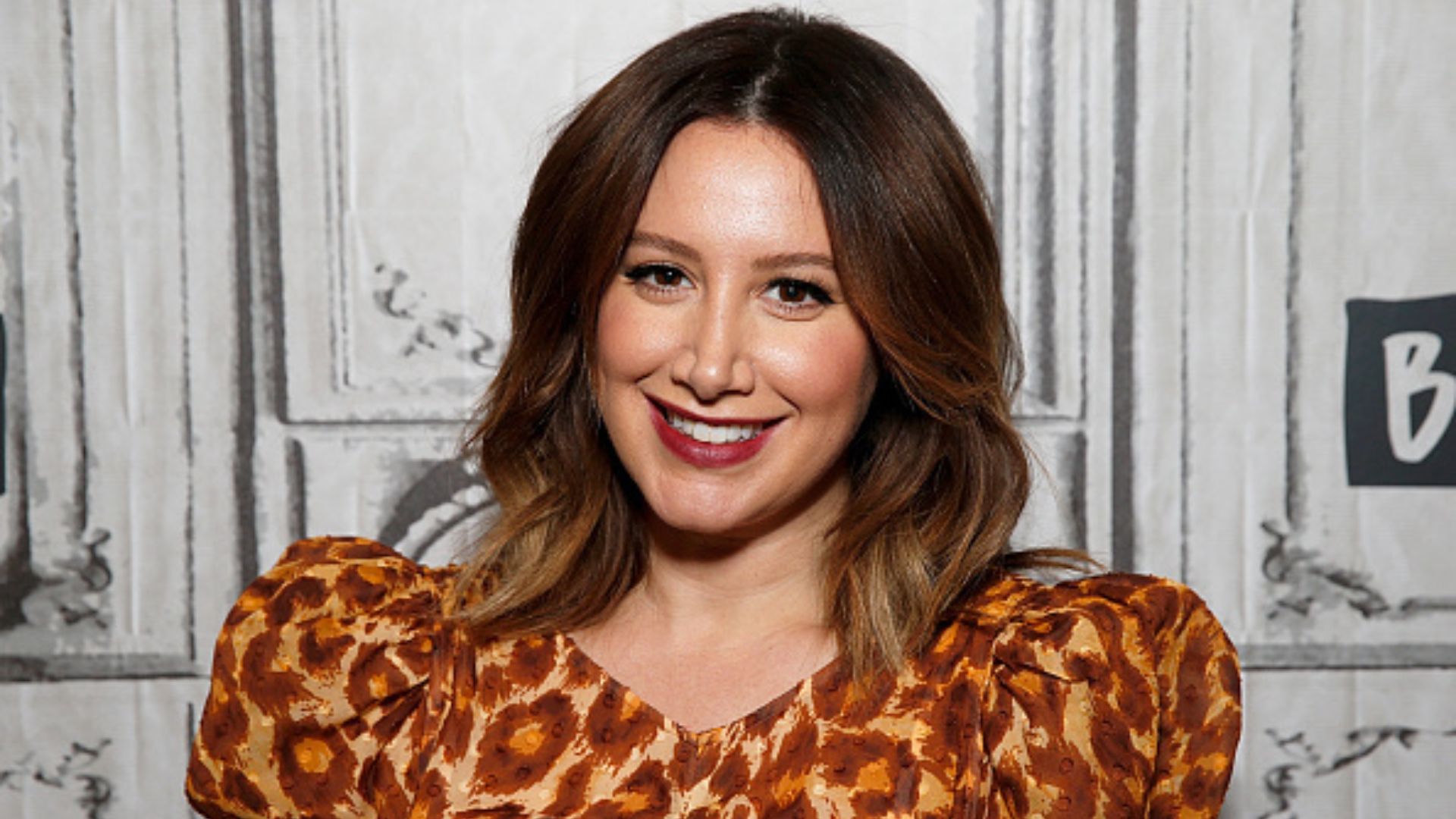 Ashley Tisdale, de High School Musical, revela luta contra alopecia