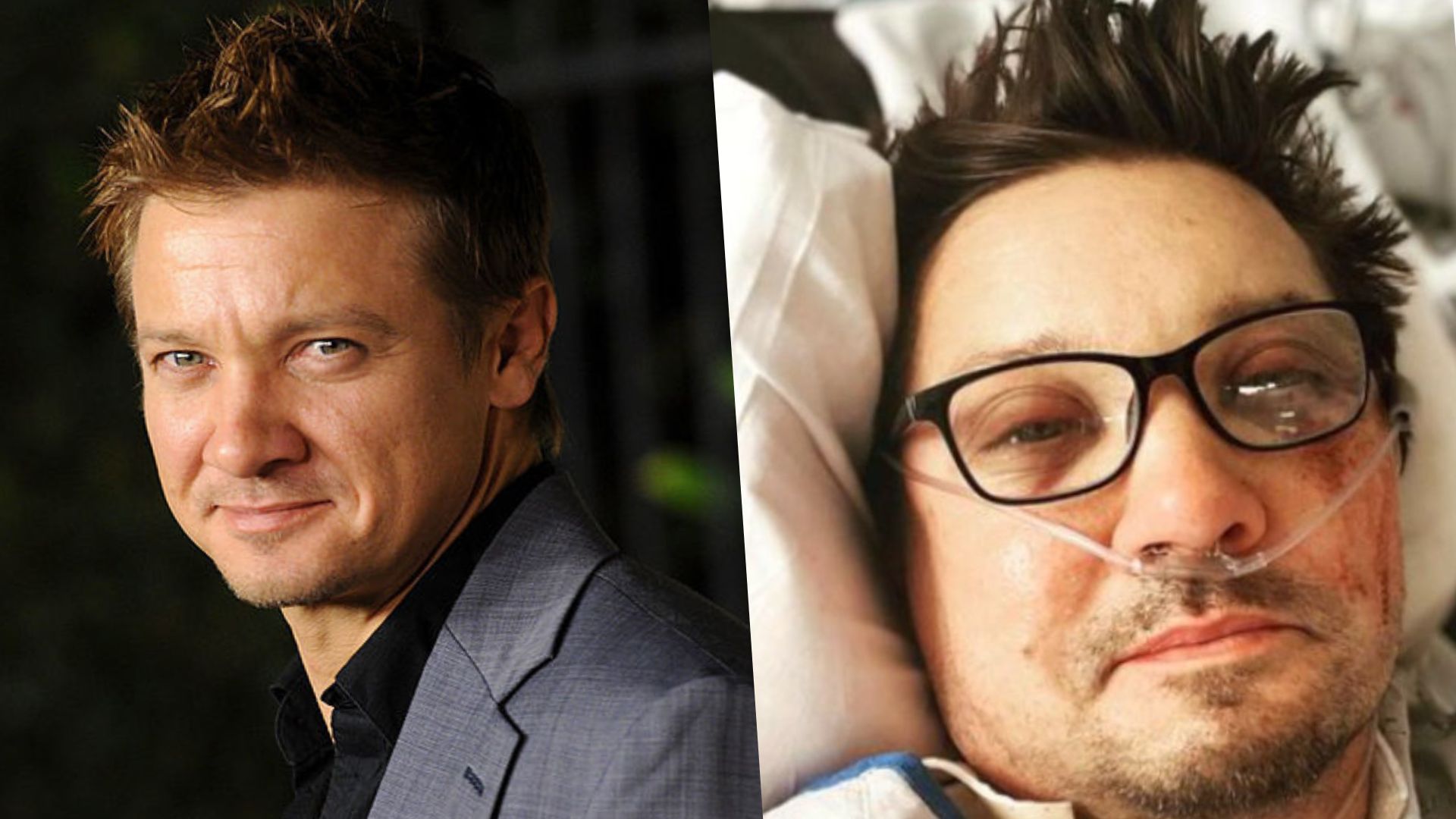 Jeremy Renner: o atual e chocante estado de saúde do ator