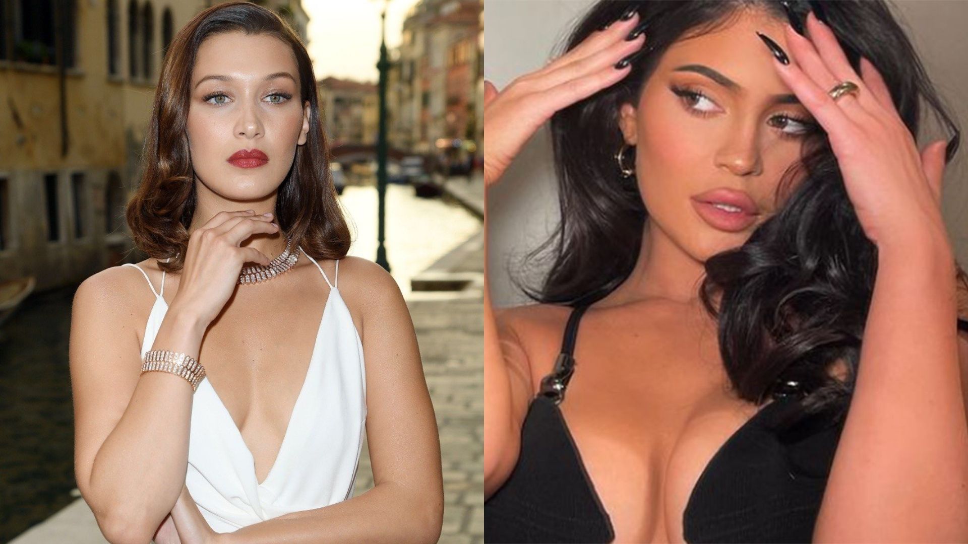 Hot or not? As plásticas dos famosos que mais deram o que falar!